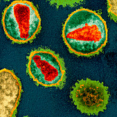 Coloured TEM of HIV viruses in a cell