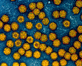 Coloured TEM of parvovirus B19 particles