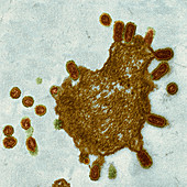 Influenza A virus strain H5N1, TEM
