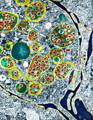 Coronavirus infection, TEM