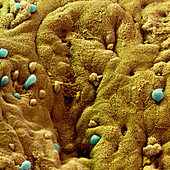 Coloured SEM of Entamoeba histolytica in colon