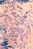 Light micrograph of Entamoeba histolytica in colon