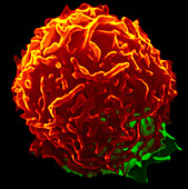 Coloured SEM of human natural killer blood cell