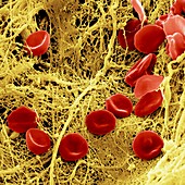 Coloured SEM of a blood clot due to an injury