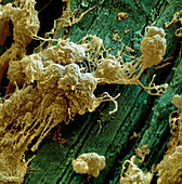 Lymphozyten auf Faden 3200x - OP-Faden mit Macrophagen