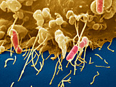 Macrophage engulfing E. coli, SEM