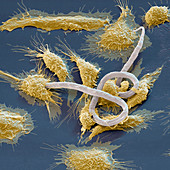 Macrophages attacking parasite, SEM