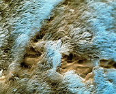 Nasal lining, SEM