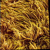Coloured SEM of the lining of a lung bronchiole