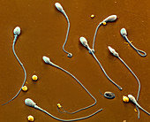 Spermien 3000x - Spermien