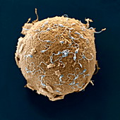Menschliche Eizelle mit Spermien