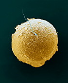 Menschliche Eizelle mit Spermium