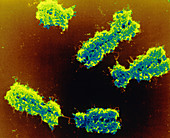 Coloured SEM of a human chromosomes
