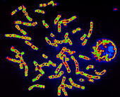 Coloured LM of a human chromosomes & nucleus