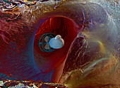 Micro-submarine in an artery