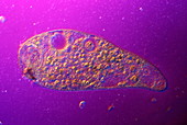 Ciliate protozoan, light micrograph