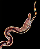 LM of an intestinal blood fluke, Schistosoma sp.