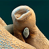 Mating schistosome flukes, SEM