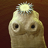 Colour SEM of the head of a tapeworm, Taenia sp.