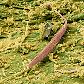 Coloured SEM of a nematode worm in a compost heap