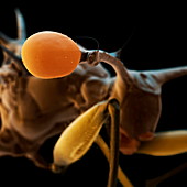 Stalk-eyed fly eye, SEM