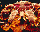 Sheep tick mouthparts, SEM