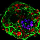 Ten day human embryo, fluorescence micrograph