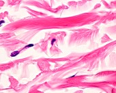 Skin collagen fibres, light micrograph