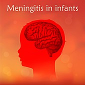 Childhood meningitis, illustration