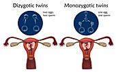 Dizygotic and monozygotic twins, illustration