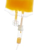 IV bag with orange juice