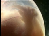 Rat embryo in capsule, light microscopy footage
