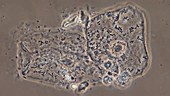 Cheek squamous epithelial cells, light microscopy