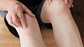 Man rubbing sore kneecap
