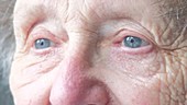 Elderly woman opening eyes