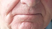 Elderly man's mouth