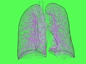 Human lungs, rotating 3D CT scan