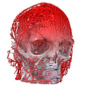 Human head and blood vessels, 3D CT scan