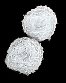 Human stem cells from bone marrow, SEM