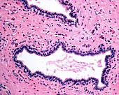 Submandibular salivary gland, light micrograph