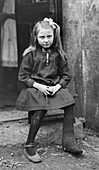 Child with tuberculosis, France, 1918