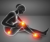 Woman with leg pain, illustration