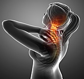Woman with neck pain, illustration