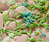 Bacteria found on dishcloth, SEM
