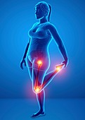 Woman with leg pain, illustration