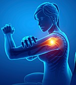 Woman with shoulder pain, illustration