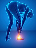 Woman with foot pain, illustration