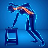 Woman with back pain, illustration