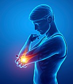 Man with elbow pain, illustration