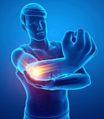 Man with elbow pain, illustration